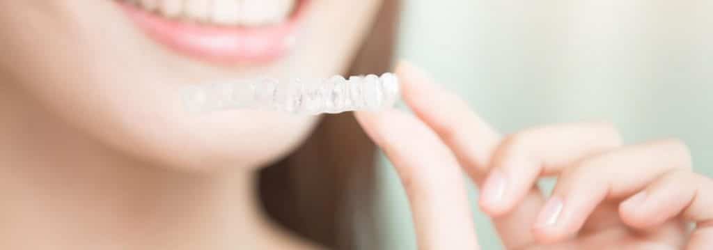 benefits of clear braces