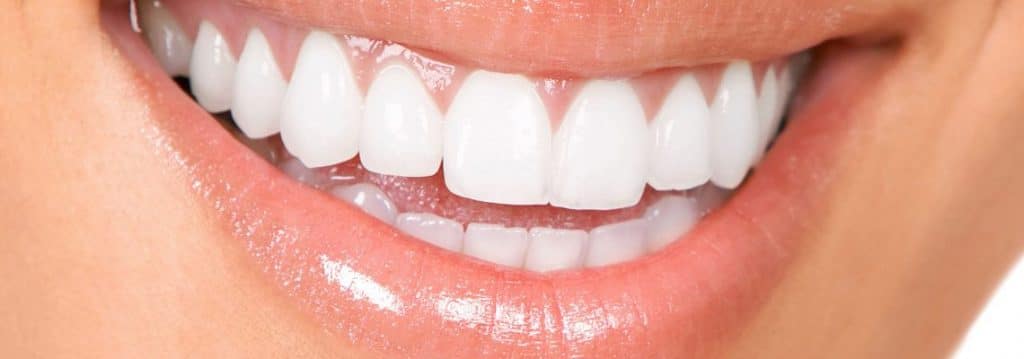 porcelain veneers vs dental habits