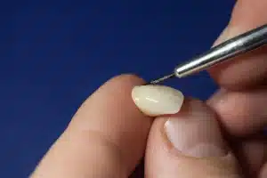 cosmetic dentist alpharetta working on veneer