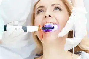 ongoing teeth whitening alpharetta