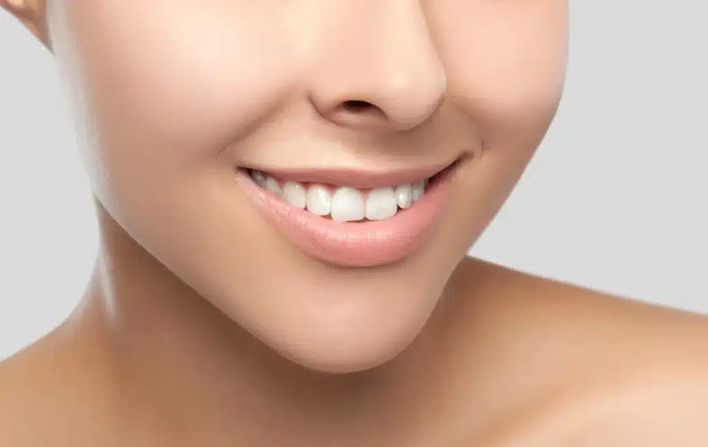 smiling after visiting a cosmetic dentist alpharetta