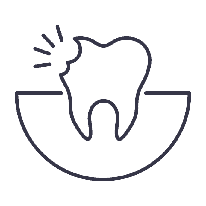 Line drawing of a tooth with a chipped corner and three lines indicating pain or damage, set above a semicircle background—perfect for highlighting dental issues addressed by a dentist in Alpharetta, GA.